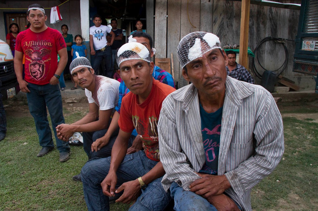 Luego de una agresión a bases de apoyo zapatistas (EZLN) del caracol La Realidad, 13 heridos pertenecientes a la CIOAC recibieron atención médica por parte de paramédicos de la Cruz Roja. Tres requirieron trasladado al hospital de Guadalupe Tepeyac. Foto Moysés Zuñiga Santiago