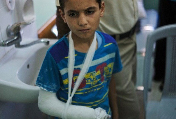 Un niño palestino se recupera en el hospital de los Mártires en Deir el-Balah, Gaza. Foto Ap