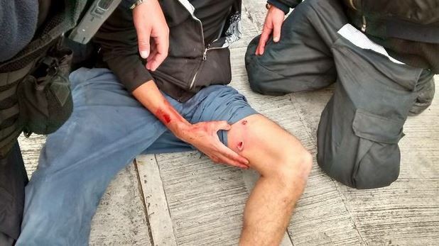 Estudiante de la UNAM recibe un disparo. Imagen tomada del Facebook Raíces Libertarias