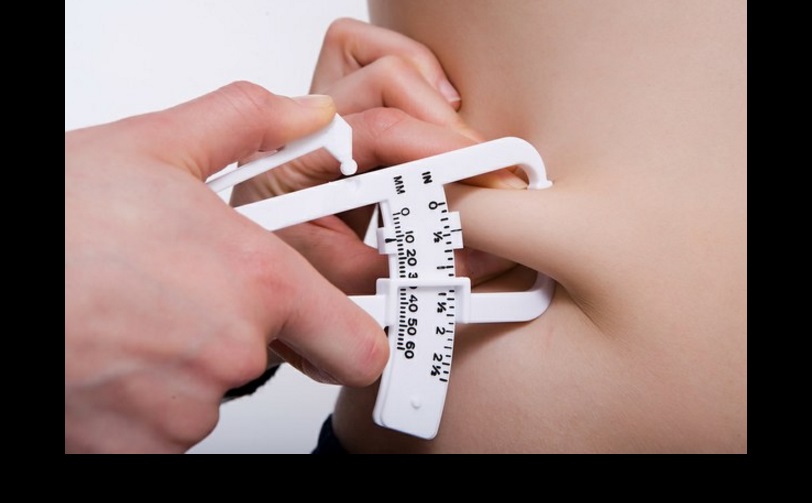 La obesidad es uno de los principales factores que propician el síndrome metabólico. Foto Agencia ID