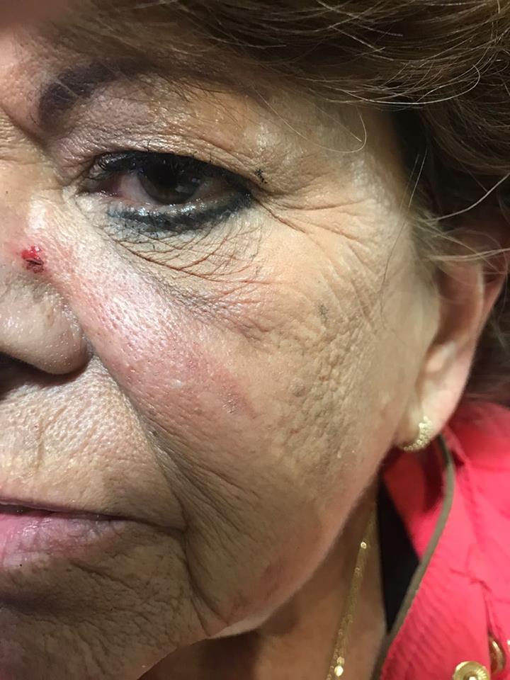 En redes sociales, la afectada denunció que recibió un golpe en la cara por parte de José Francisco Santiváñez ■ FOTO: FACEBOOK